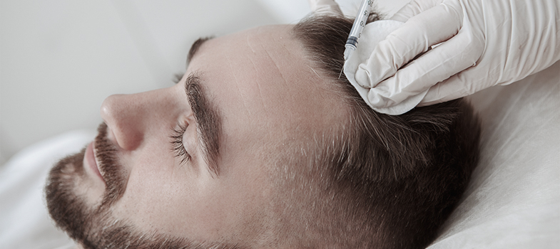 Patient erhält PRP-Injektion in Kopfhaut